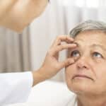 Thyroid Eye Disease St. Louis, MO