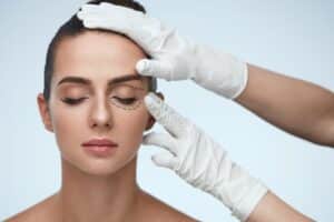 blepharoplasty, St. loius. MO