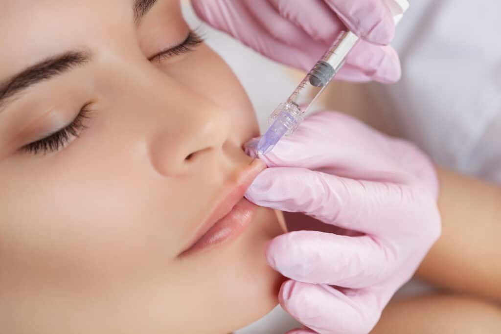 Juvederm Injections St. Louis MO | Lip Filler