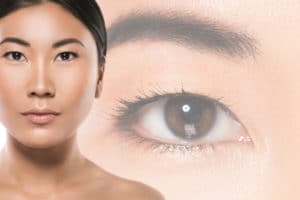 Revision Blepharoplasty: What You Need to Know