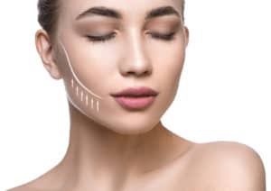 Close up portrait of a beautiful woman with lifting lines on the face. A visual representation of a cheek lift.