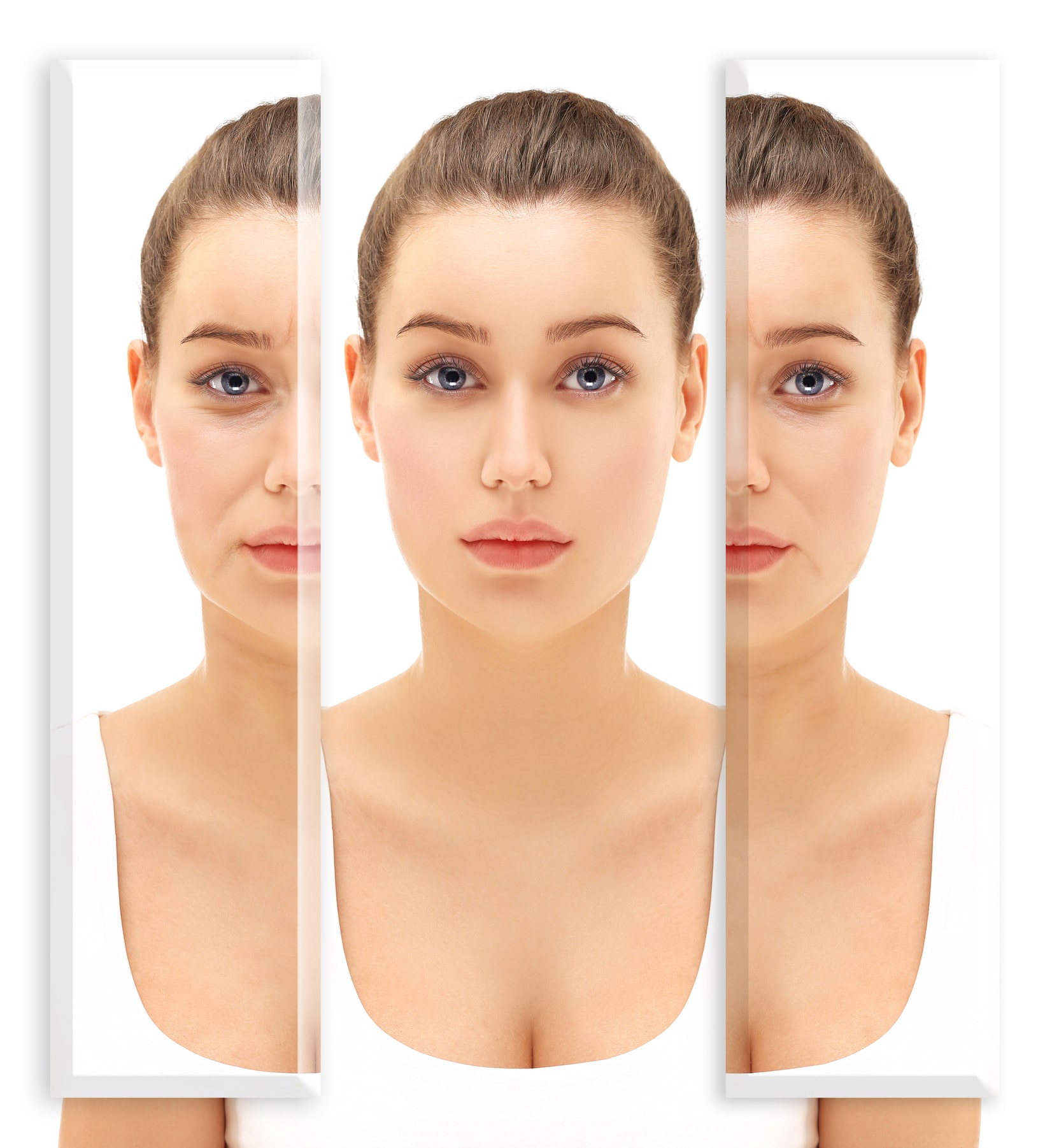Sculptra® Injections <br /><small>in St. Louis &#038; St. Peters MO</small>