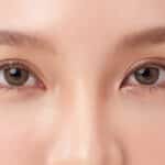 How Does Asian Eyelid Surgery Differ From Traditional Eyelid Surgery?