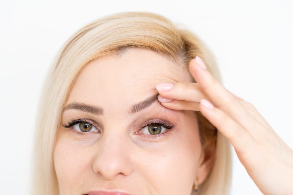 Woman with drooping eyelid holding it up